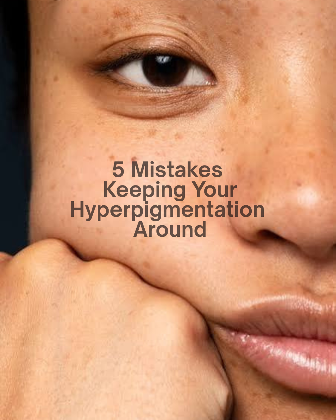 Why Your Dark Spots Aren't Fading (And What to Do Instead)